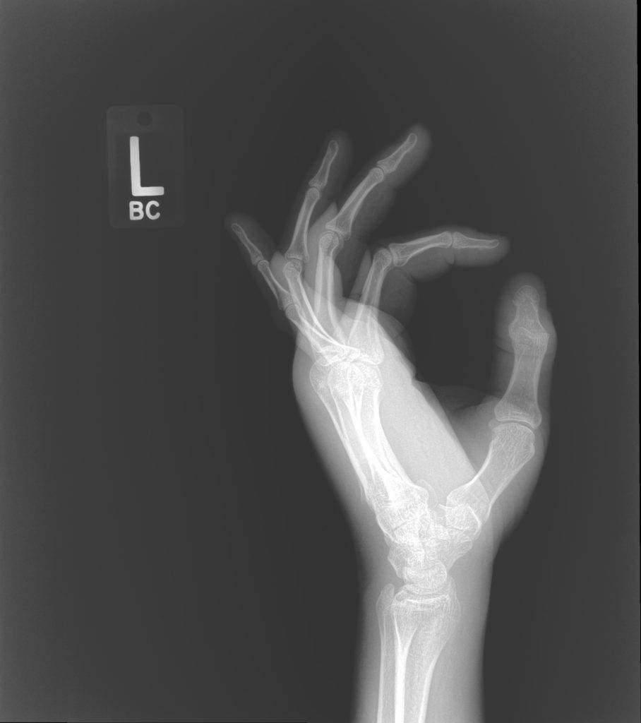 xray1.